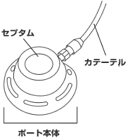 カテーテル