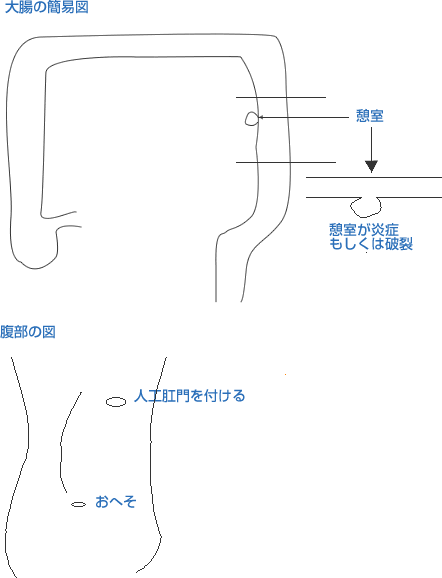 先生から受けた説明